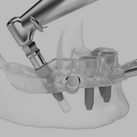 guided-surgery