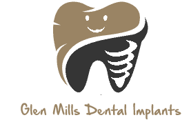 Glen Mills Dental Implants
