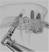 guided-surgery-3