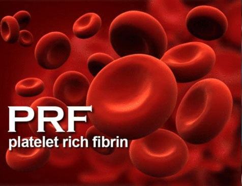pdf-1